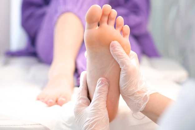 Как лечить большое расстояние между большим пальцем на ногах?