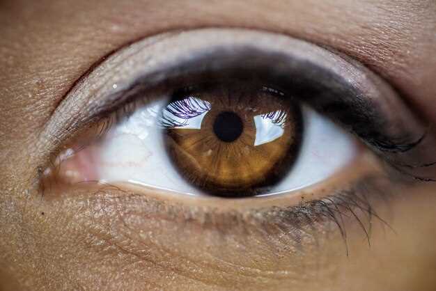 Гетерохромия глаз: определение и причины