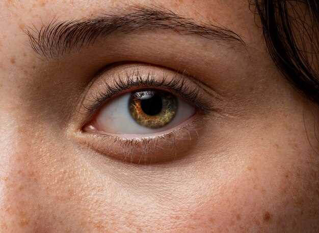 Гетерохромия: глаза с разным цветом - особенность или болезнь